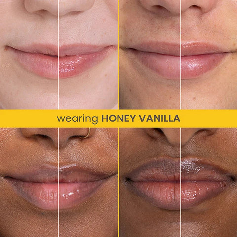Rescue Lip Relief